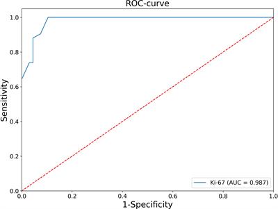 The new histological system for the diagnosis of adrenocortical cancer